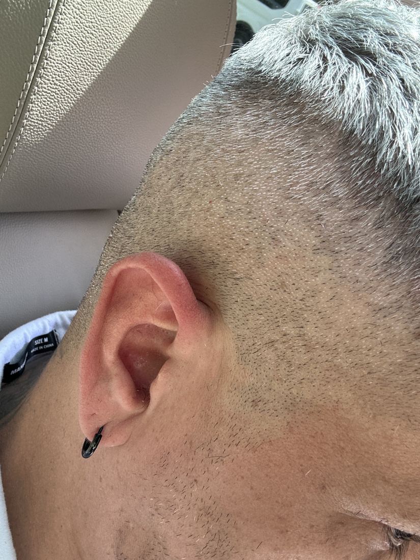 A fresh skin fade